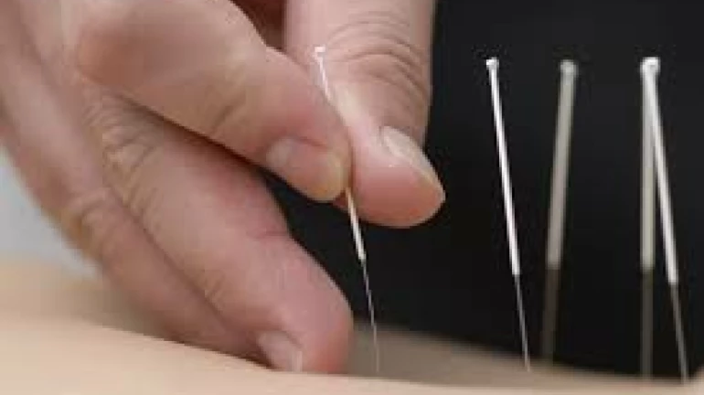 Maharashtra Acupuncture Council approves 12 new acupuncture colleges Maharashtra Acupuncture Council approves 12 new acupuncture colleges
