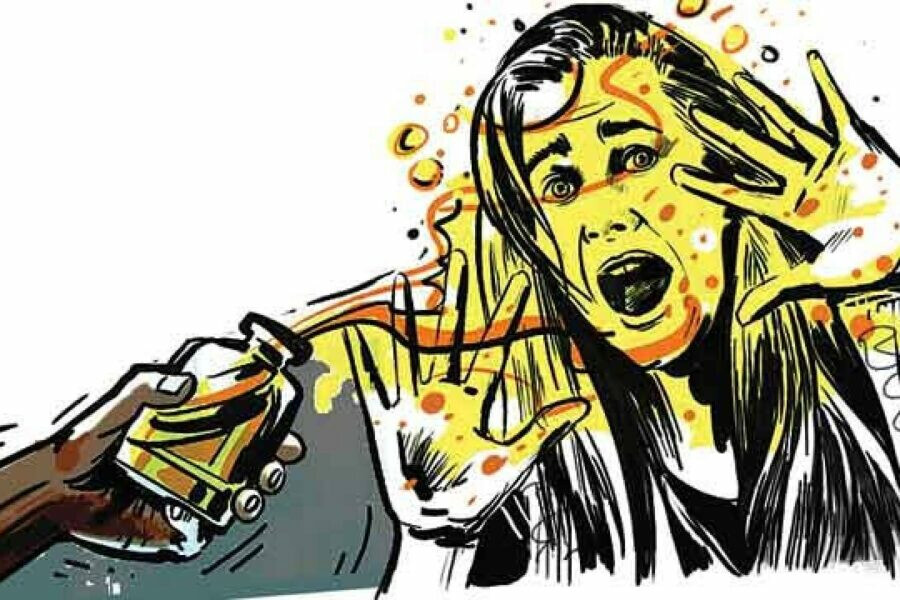 Case registered against 28 year old man for attacking wife with acid