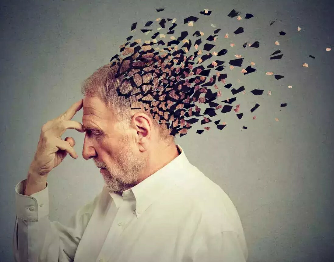 Only 10% Alzheimer patients receive medical intervention on time