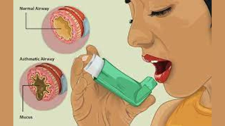 Asthma Day: Pigeon poop hazardous for such patients in Mumbai, neighbouring cities Asthma Day: Pigeon poop hazardous for such patients in Mumbai, neighbouring cities