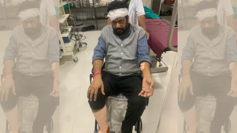 विधायक बच्चू कडू हादसे मे घायल विधायक बच्चू कडू हादसे मे घायल