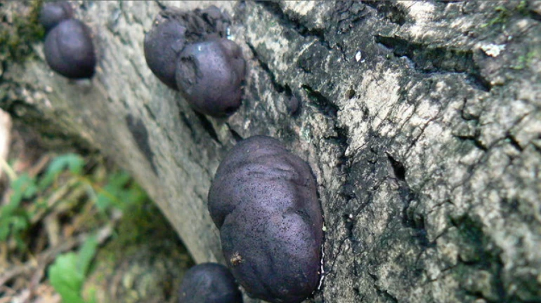 Maharashtra: 1700 active mucormycosis cases; Mumbai saw a mortality rate of 20% Maharashtra: 1700 active mucormycosis cases; Mumbai saw a mortality rate of 20%