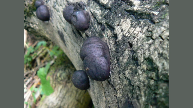 Maharashtra: Families Impacted by Steep Cost and Shortage of Black Fungus Treatment Drugs Maharashtra: Families Impacted by Steep Cost and Shortage of Black Fungus Treatment Drugs