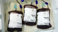 FDA ने पूरे महाराष्ट्र में ब्लड बैंकों पर कार्रवाई की FDA ने पूरे महाराष्ट्र में ब्लड बैंकों पर कार्रवाई की
