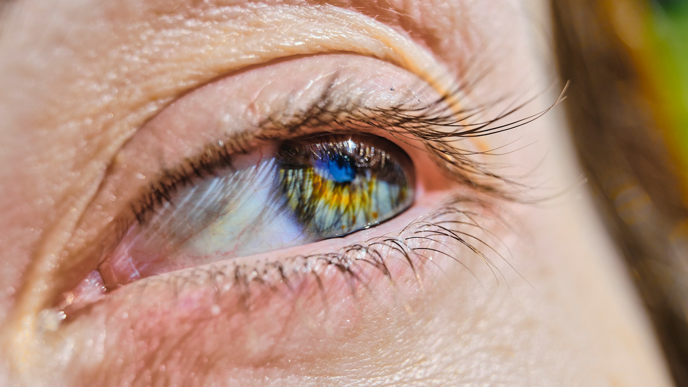 Special cataract surgery campaign extended till March 9