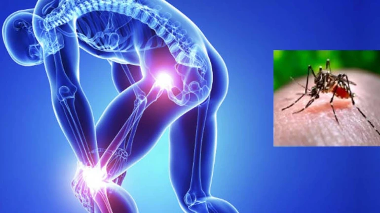 डेंग्यूनंतर चिकनगुनियाचे रुग्ण महाराष्ट्र आणि मुंबईत अधिक डेंग्यूनंतर चिकनगुनियाचे रुग्ण महाराष्ट्र आणि मुंबईत अधिक