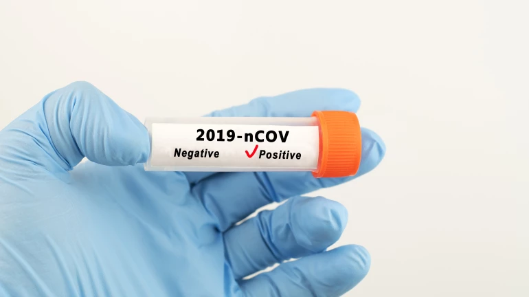 Recommendation to Avoid Alcohol After COVID-19 Vaccination Confuses Doctors Recommendation to Avoid Alcohol After COVID-19 Vaccination Confuses Doctors