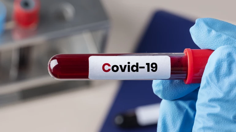 Seven districts of Maharashtra have high COVID-19 prevalence Seven districts of Maharashtra have high COVID-19 prevalence