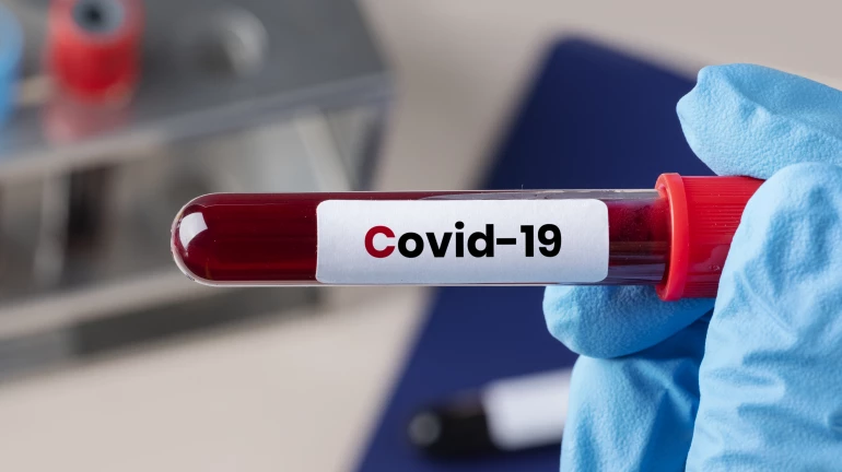 Mumbai records 2,877 new coronavirus cases, highest one-day spike since pandemic outbreak