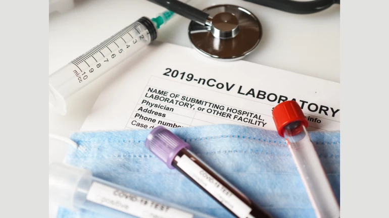 Period till Mid-December crucial : BMC Period till Mid-December crucial : BMC