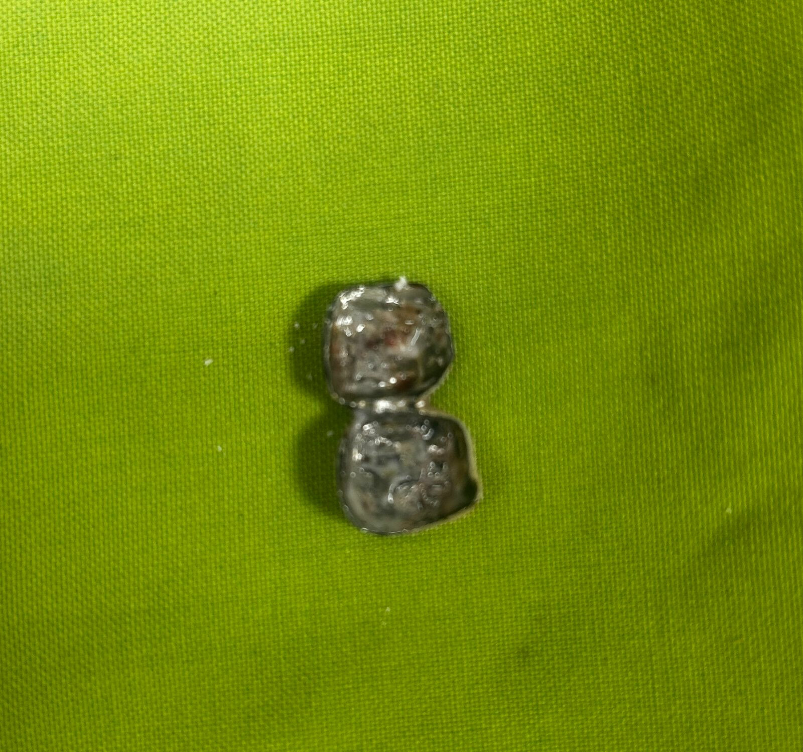 Dental Mishap Turns Critical: 78-Year-Old Mumbai Man Saved After Dental Cap Enters Lung