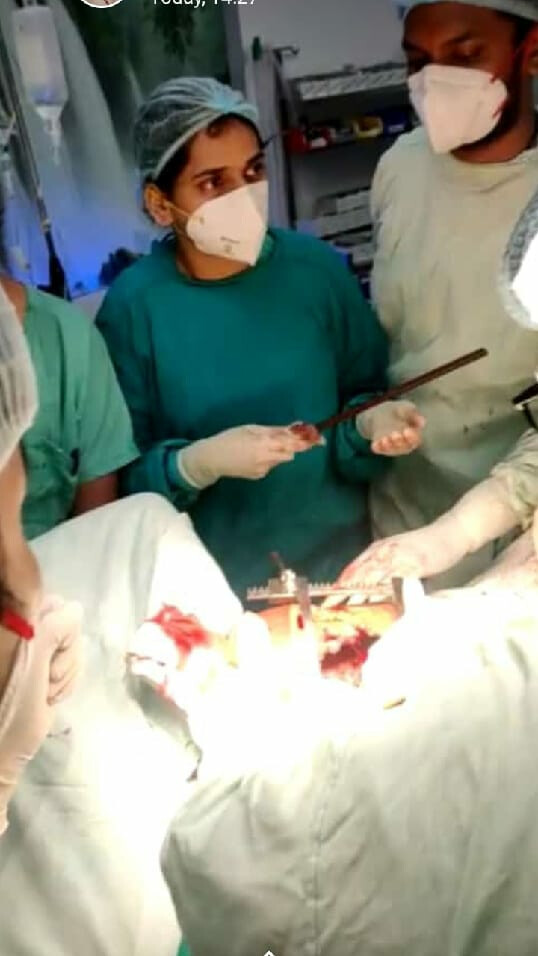 18-inch iron rod pierces through a woman's chest at a construction site in Vikhroli; BMC doctors save life