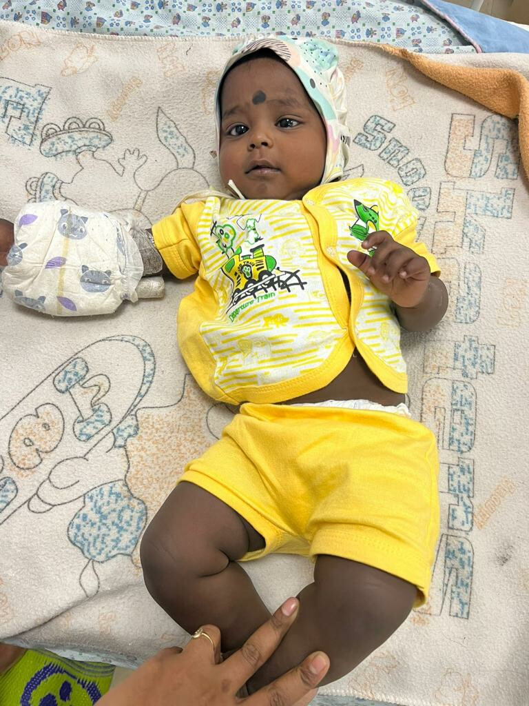 6-Month-Old Baby Successfully Treated For Eye Cancer At Mumbai Hospital