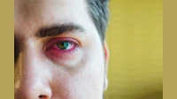 Mumbai Monsoon and Your Eyes: What Mumbaikar Needs to Know From Symptoms, Prevention, Treatments Mumbai Monsoon and Your Eyes: What Mumbaikar Needs to Know From Symptoms, Prevention, Treatments