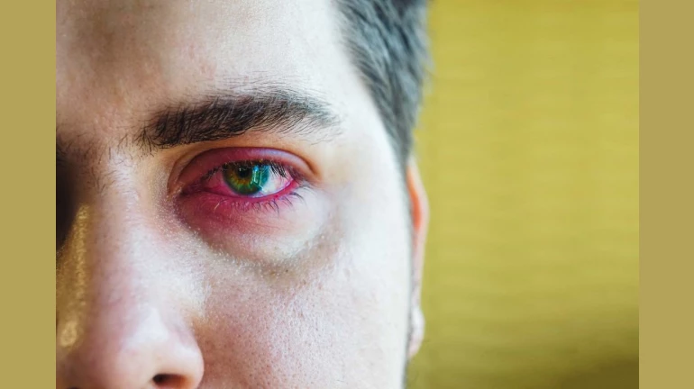 How to take care of eyes during severe pollution How to take care of eyes during severe pollution