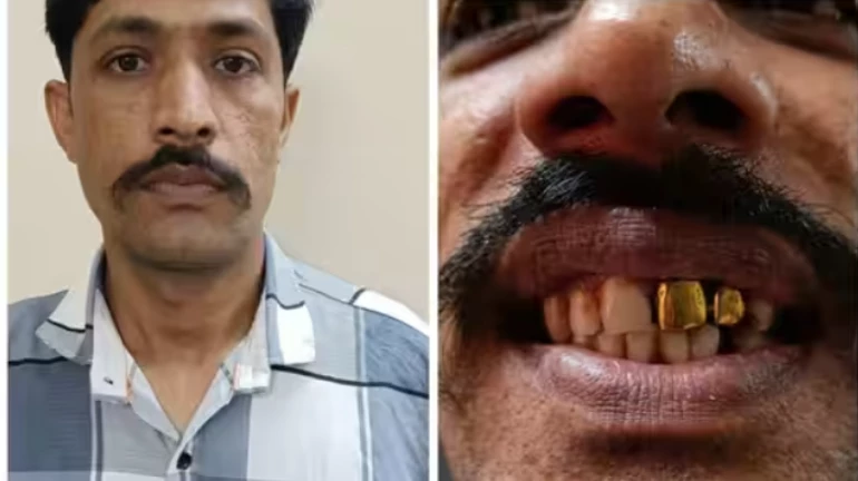 Mumbai Police nabs fugitive through gold-plated teeth after 15 years of chase