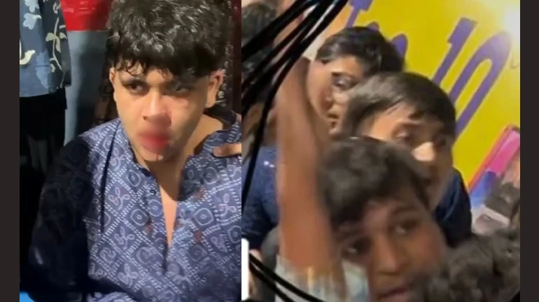 गोरेगाव नेस्को दांडिया महोत्सवात तरुणाला बेदम मारहाण गोरेगाव नेस्को दांडिया महोत्सवात तरुणाला बेदम मारहाण