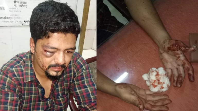Mumbai journalist Herman Gomes attacked outside his house on Sunday Mumbai journalist Herman Gomes attacked outside his house on Sunday