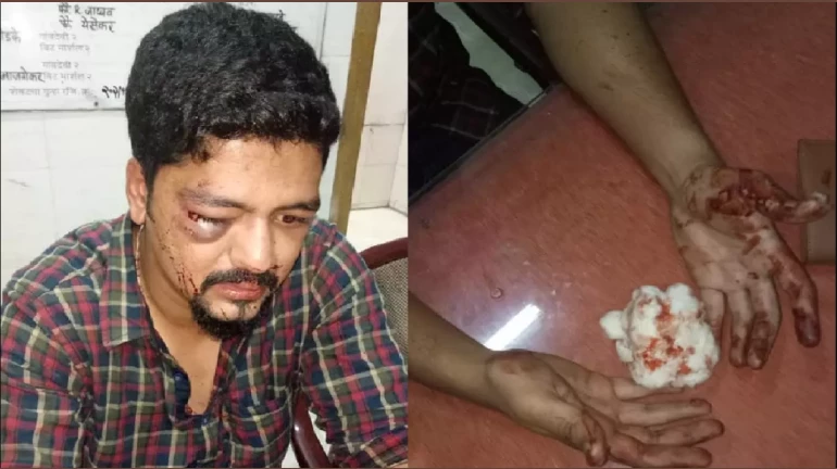 Mumbai Journalist Attack: Four Arrested For Assaulting Hermon Gomes Mumbai Journalist Attack: Four Arrested For Assaulting Hermon Gomes