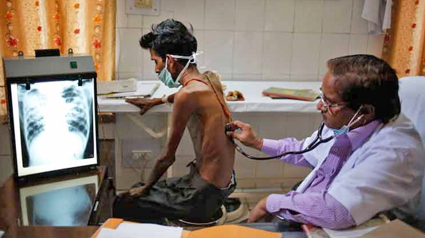 १२ ते २४ नोव्हेंबरदरम्यान पालिकेची टीबी नियंत्रणासाठी विशेष मोहीम