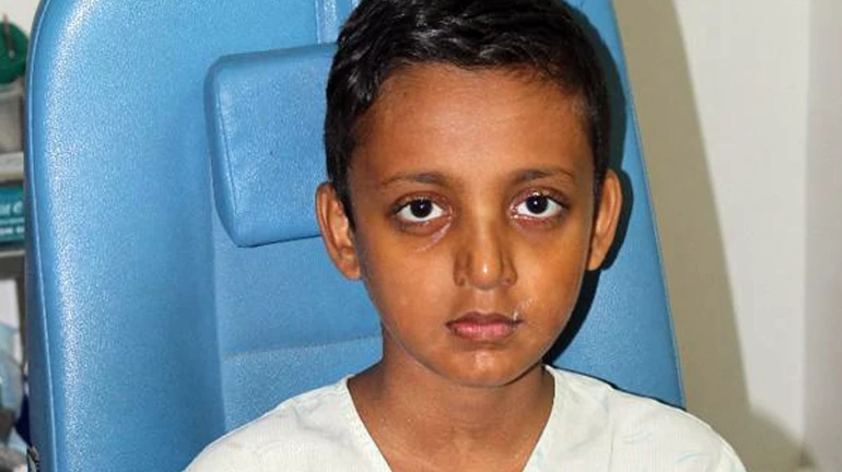 ११ वर्षीय मुलावर तब्बल ३० शस्त्रक्रिया