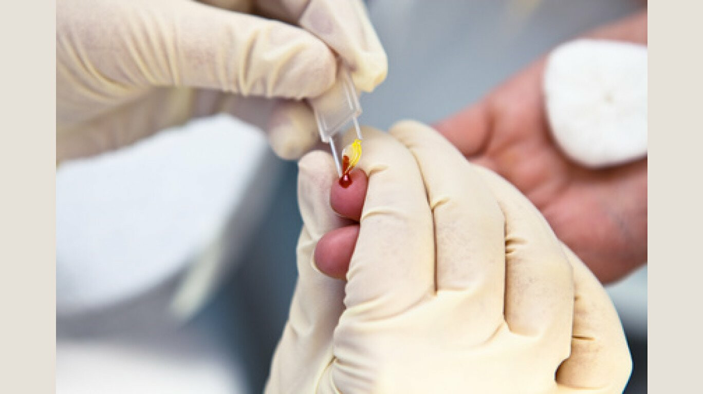 अप्रैल में शुरू होगी ‘आपली चिकित्सा'।