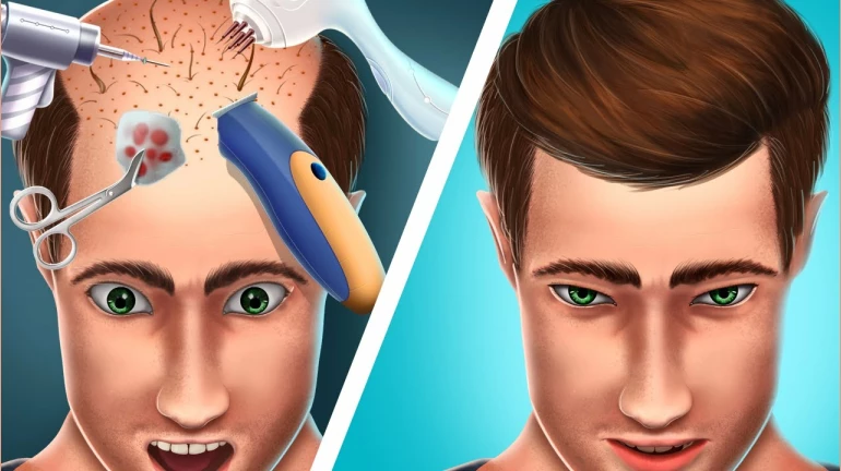 Mumbai businessman dies 50 hours after hair transplant Mumbai businessman dies 50 hours after hair transplant