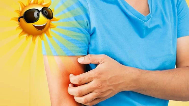 उन्हाळ्यात अंगाला खाज उठते? या ७ घरगुती उपायांनी करा समस्या दूर उन्हाळ्यात अंगाला खाज उठते? या ७ घरगुती उपायांनी करा समस्या दूर