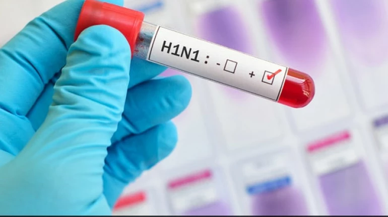 H1N1 ने मुंबई में दो महिलाओं की मौत H1N1 ने मुंबई में दो महिलाओं की मौत