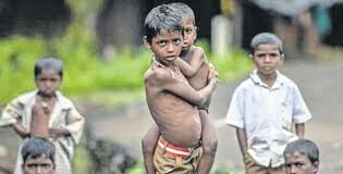 मीरा भायंदर इलाके में 157 कुपोषित बच्चे