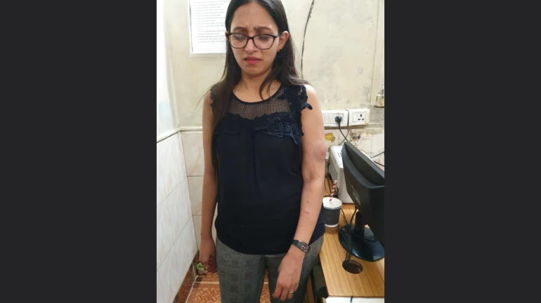 लोकलमध्ये धक्का लागल्याने तिने घेतला तरूणीला चावा लोकलमध्ये धक्का लागल्याने तिने घेतला तरूणीला चावा