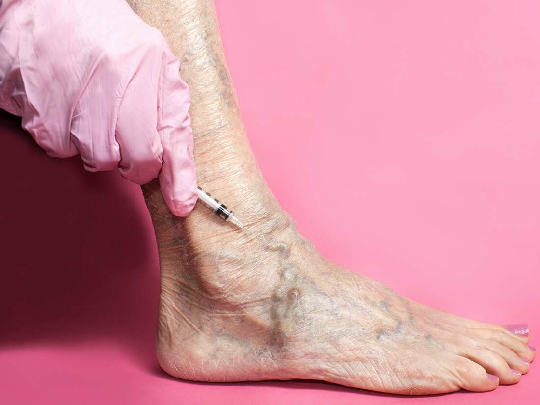 पायातील वेदनांकडं दुर्लक्ष केल्यास होऊ शकतो 'हा' आजार