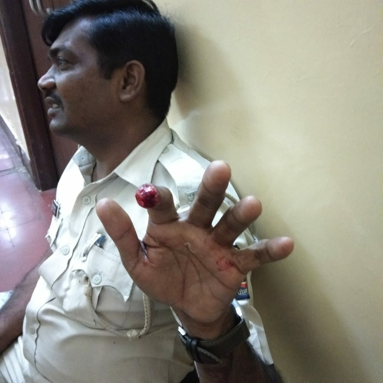 'गोलमाल' सिनेमातील दृश्याप्रमाणे त्याने पोलिसांच्या बोटाचा तुकडाच पाडला