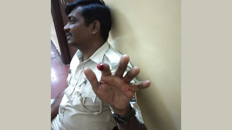 विक्षिप्त ने पुलसीकर्मी का हाथ इतनी जोर से काटा उंगली ही अलग हो गयी विक्षिप्त ने पुलसीकर्मी का हाथ इतनी जोर से काटा उंगली ही अलग हो गयी