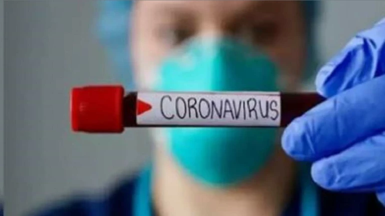 Coronavirus Updates: रेल्वे प्रवाशांचं स्क्रीनिंग करण्यासाठी राज्य सरकारची रेल्वेला विनंती Coronavirus Updates: रेल्वे प्रवाशांचं स्क्रीनिंग करण्यासाठी राज्य सरकारची रेल्वेला विनंती