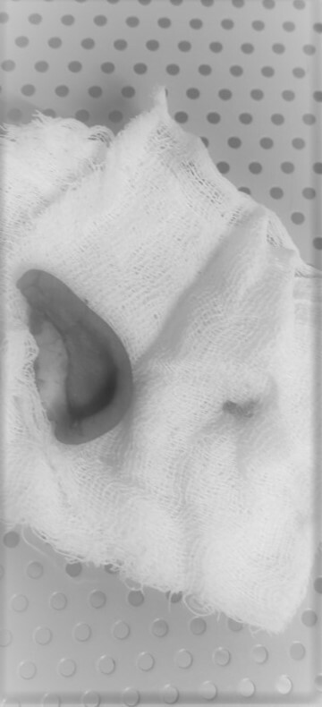 धुलिवंदनाची वर्गणी नाही दिली म्हणून कानच चावून काढला