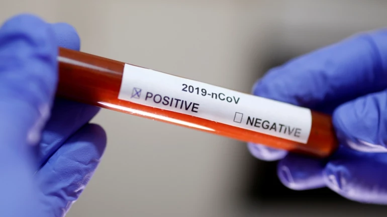 Coronavirus Pandemic: ICMR moves tender to manufacture 1 million testing kits for COVID-19