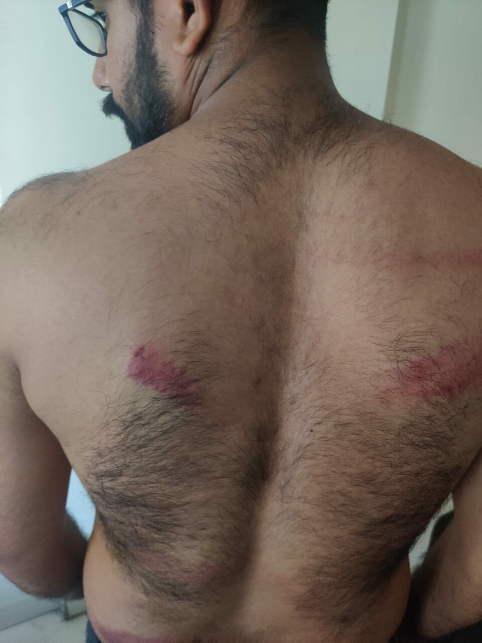 पोलिसांनी पण संयम पाळायला हवा, ठाण्यात पत्रकाराला तर वसईत नर्सला मारहाण