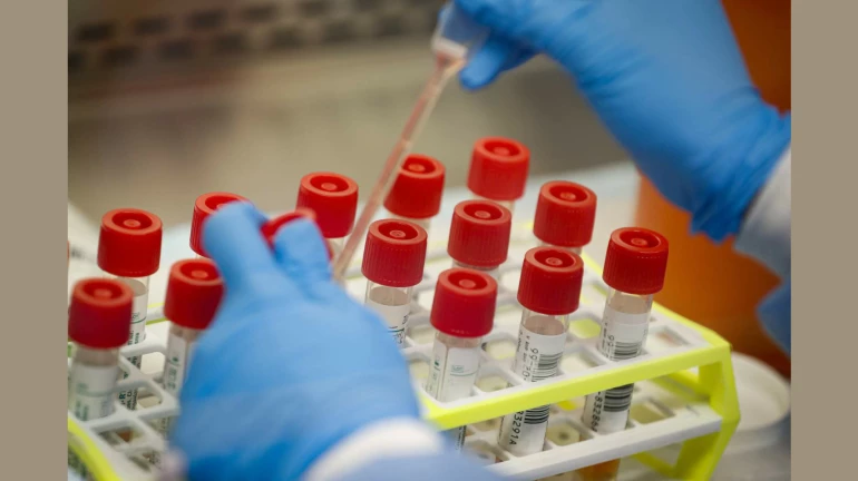 coronavirus update: कोरोनाचं निदान फक्त ५ मिनिटांत, रॅपिड टेस्टला परवानगी मिळाली coronavirus update: कोरोनाचं निदान फक्त ५ मिनिटांत, रॅपिड टेस्टला परवानगी मिळाली