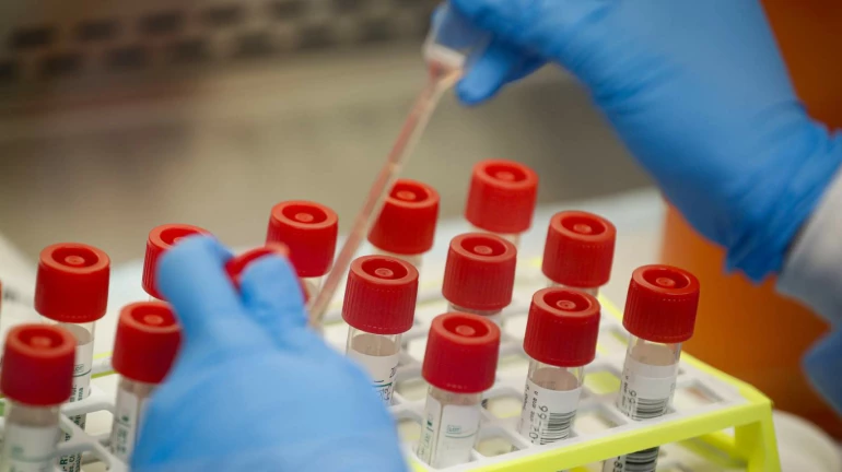 Maharashtra Reports 10,483 Coronavirus Cases In 24 Hours, 300 New Deaths Maharashtra Reports 10,483 Coronavirus Cases In 24 Hours, 300 New Deaths