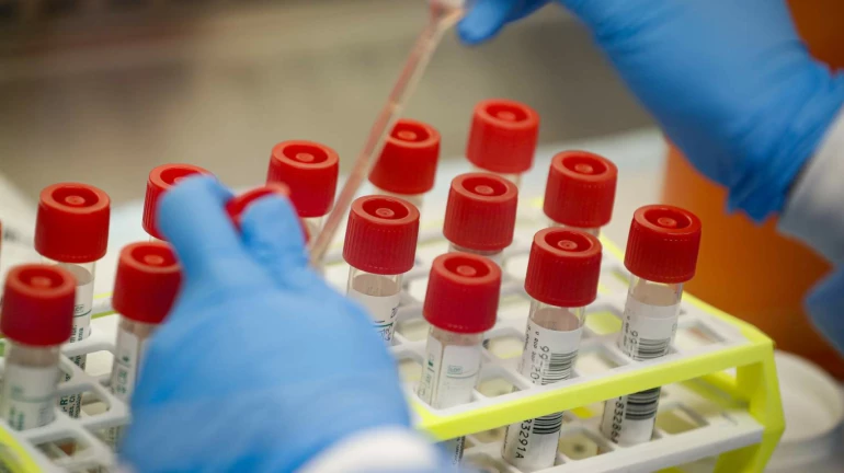 Coronavirus Pandemic: Medical colleges in state to run viral-diagnosis labs Coronavirus Pandemic: Medical colleges in state to run viral-diagnosis labs