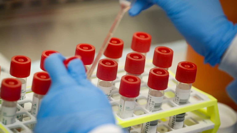 जसलोक अस्पताल के 21 स्टाफ में कोरोना के लक्षण जसलोक अस्पताल के 21 स्टाफ में कोरोना के लक्षण