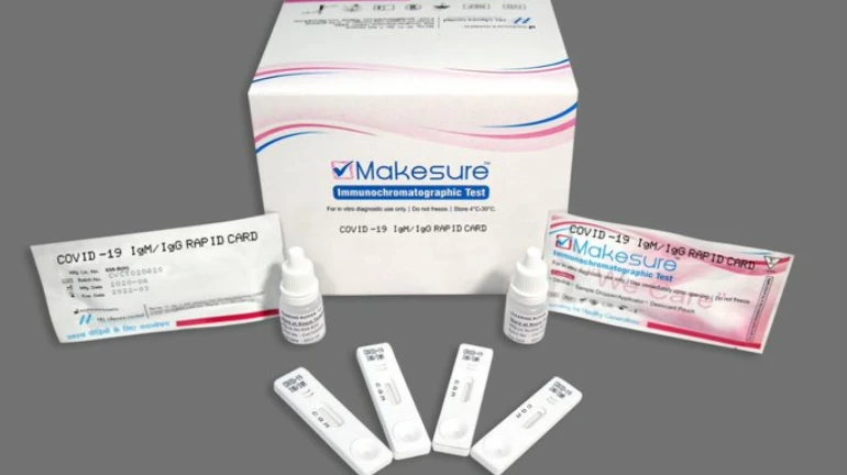 भारतीय कंपनीकडून कोरोनाची अँटीबॉडी किट तयार भारतीय कंपनीकडून कोरोनाची अँटीबॉडी किट तयार