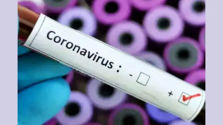 कोरोना वायरस - नवी मुंबई में एक आईटी कंपनी में 19 कर्मचारी पॉजिटिव कोरोना वायरस - नवी मुंबई में एक आईटी कंपनी में 19 कर्मचारी पॉजिटिव