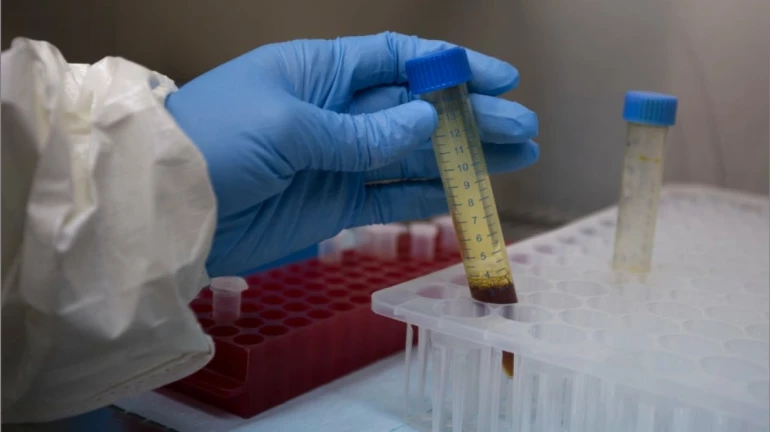 Coronavirus Update: मुंबईतील कोरोनाबाधितांवर होणार प्लाझ्मा थेरपीचा प्रयोग Coronavirus Update: मुंबईतील कोरोनाबाधितांवर होणार प्लाझ्मा थेरपीचा प्रयोग