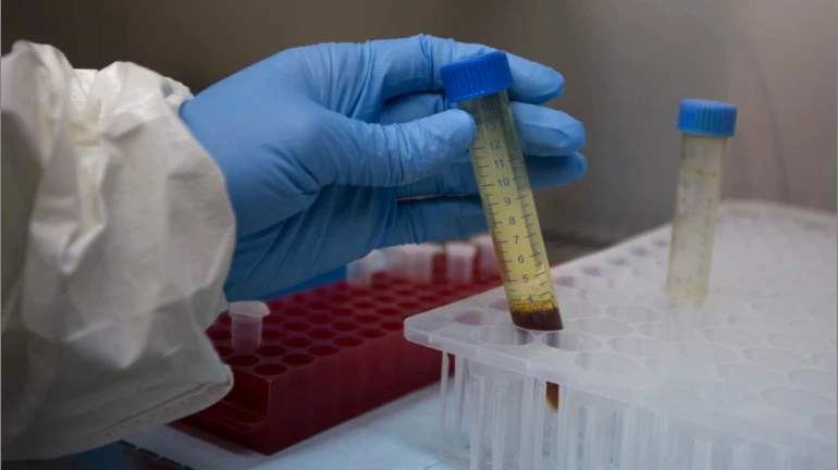 Plasma trials suffer as potential donors fear reinfection Plasma trials suffer as potential donors fear reinfection