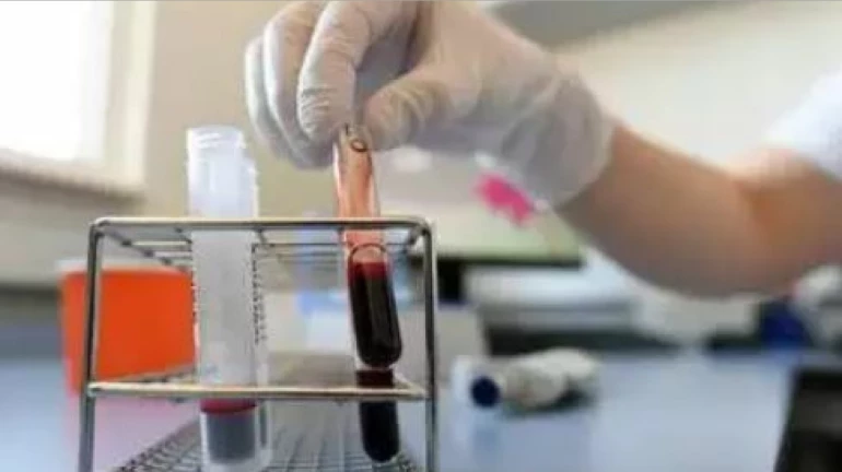 Coronavirus: KEM hospital starts a plasma bank
