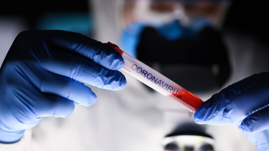 Mumbai Cost Of Covid 19 Tests At Private Labs Could Be Capped To Rs 2 300 Mumbai