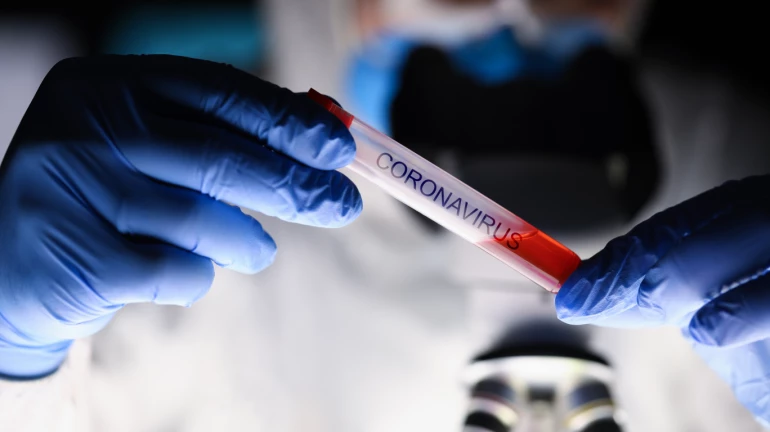 बीएमसी का नया फरमान, कोरोना पॉजिटिव होने पर मरीजों को नहीं बताई जाएगी रिपोर्ट बीएमसी का नया फरमान, कोरोना पॉजिटिव होने पर मरीजों को नहीं बताई जाएगी रिपोर्ट