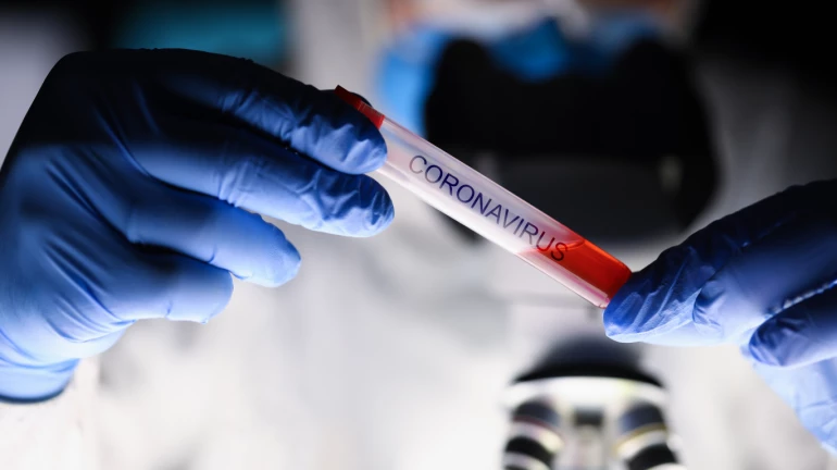 'या' प्रयोगशाळांमध्ये जाऊन करता येईल तुम्हाला कोरोना चाचणी! 'या' प्रयोगशाळांमध्ये जाऊन करता येईल तुम्हाला कोरोना चाचणी!